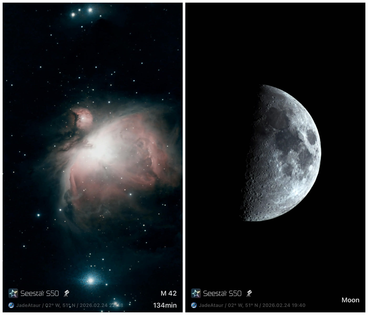 When the Sky Came to Andy: Capturing the Night from a Hospital Bed with Seestar